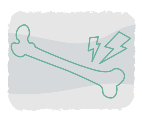 CML: Muskel- oder Knochenschmerzen Grafische Darstellung eines Knochens