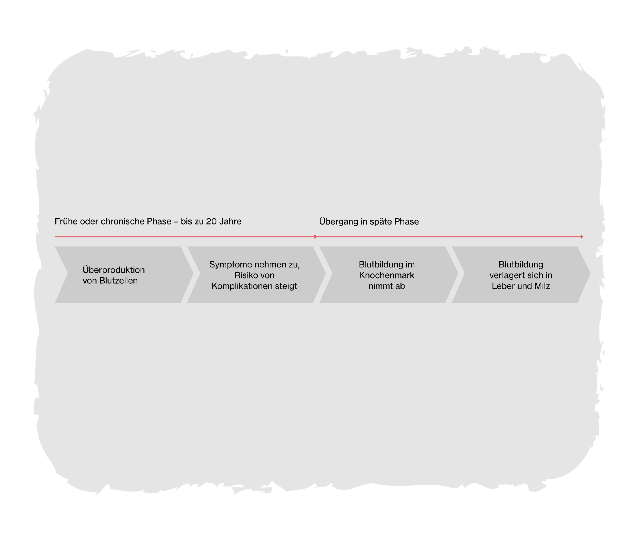 Flussdiagramm der Phasen der Polycythaemia vera: von Überproduktion von Blutzellen bis zur Verlagerung der Blutzellbildung in Leber und Milz.