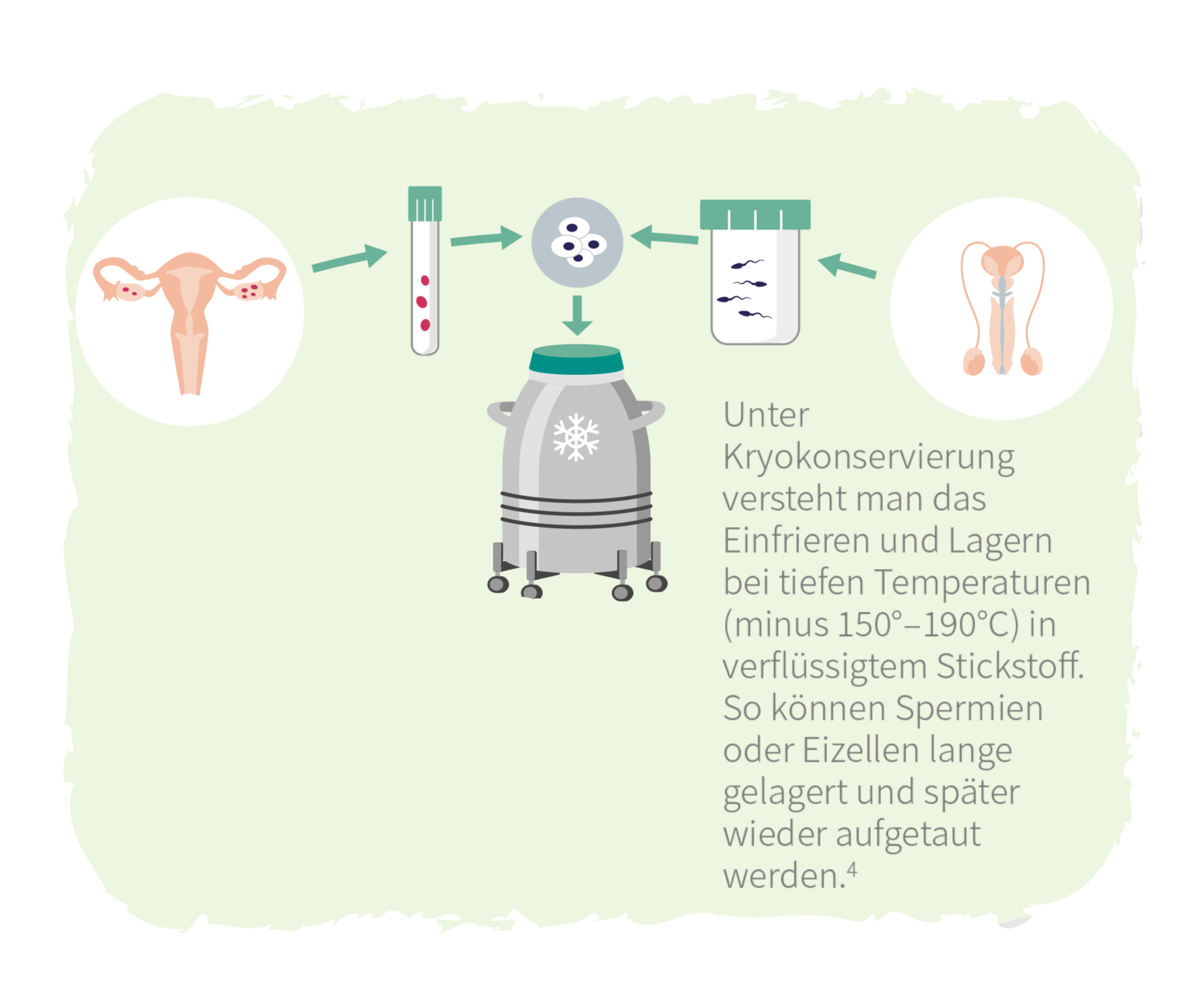 Grafische Darstellung des Vorgangs der Kryokonservierung von Eizellen und Spermien. Am Rand ist dieser Text abgebildet: Unter Kryokonservierung versteht man das Lagern bei tiefen Temperaturen von minus 150 bis 190 Grad Celsius in verflüssigtem Stickstoff. So können Spermien oder Eizellen lange gelagert und später wieder aufgetaut werden.