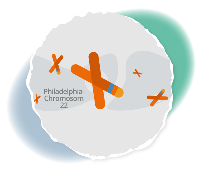 CML: Zytogenetische Remission Schematische Darstellung des Philadelphia-Chromosoms.