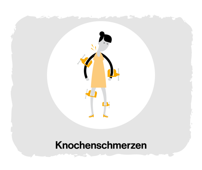 MF: Knochenschmerzen Grafik einer Frau, die an ihren Knien und Ellenbogengelenken Schraubstöcke trägt.