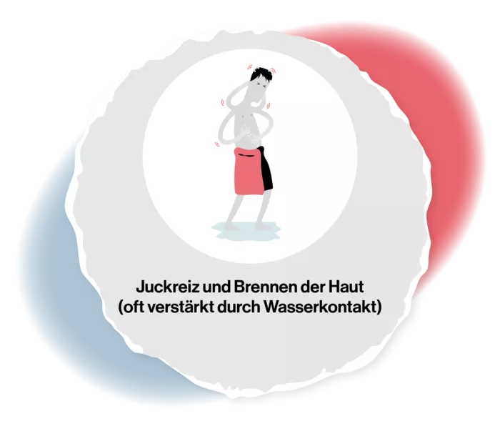 Grafik einer Person, die ein Handtuch um die Hüften gebunden hat und die sich überall am Körper kratzt. 