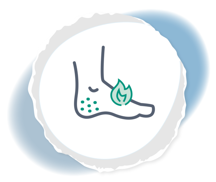 Die Grafik eines Fußes, der in Flammen steht und Punkte an der Ferse aufweist. 