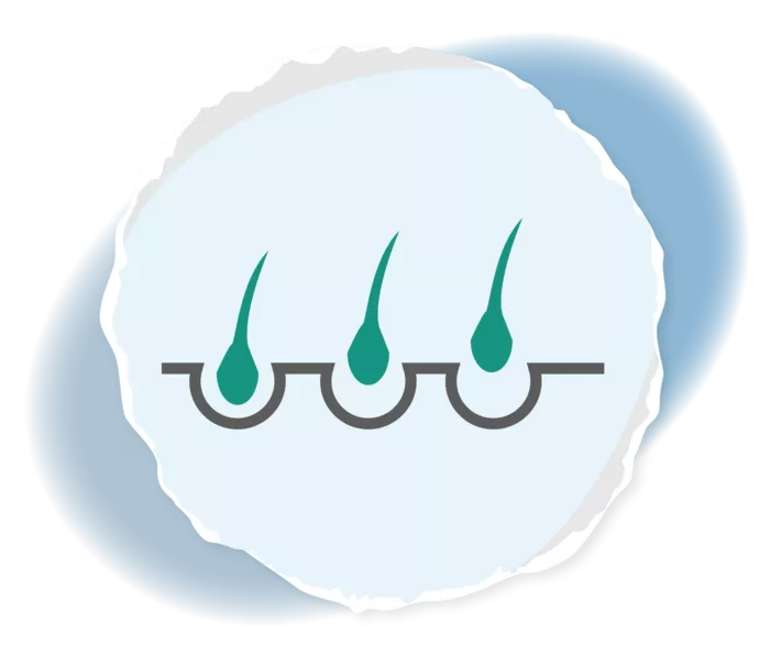 Grafik von Haarwurzeln und Haaren, die sich lösen. 