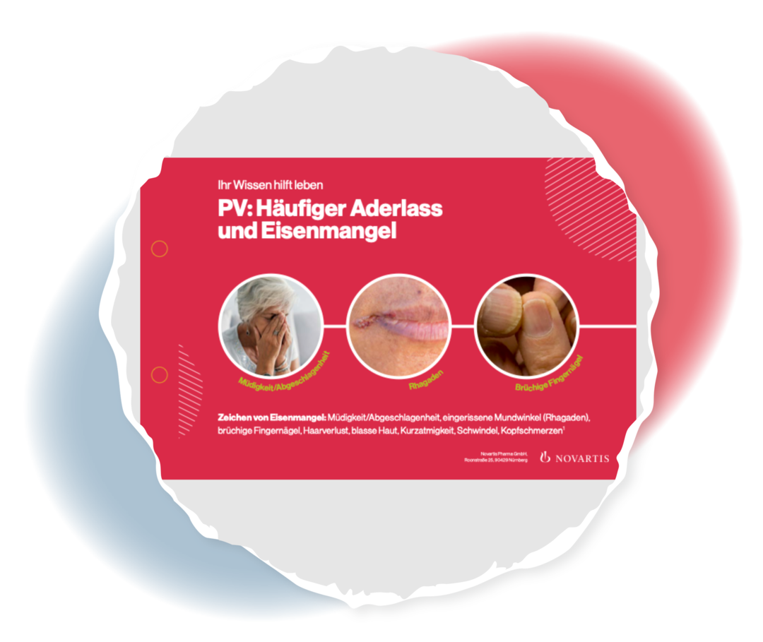 Titelseite der Themenkarte „PV: Häufiger Aderlass und Eisenmangel“.