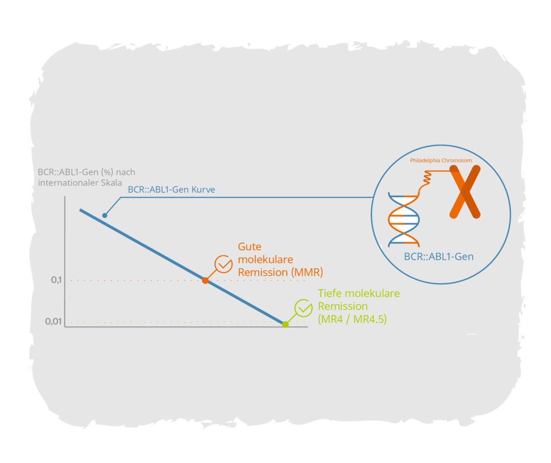 Leben mit CML: Therapie und Schwangerschaft Grafik zeigt ein Diagramm. Die y-Achse ist beschriftet mit „BCR::ABL1-Gen (in Prozent) nach internationaler Skala“. Das Diagramm zeigt eine BCR::ABL1-Gen-Kurve. Zwei Stellen der Kurve sind markiert mit „Gute molekulare Remission (MMR)“ und „Tiefe molekulare Remission (MR4/MR4.5)“. Darüber ist eine grafische Darstellung des BCR::ABL1-Gens abgebildet.