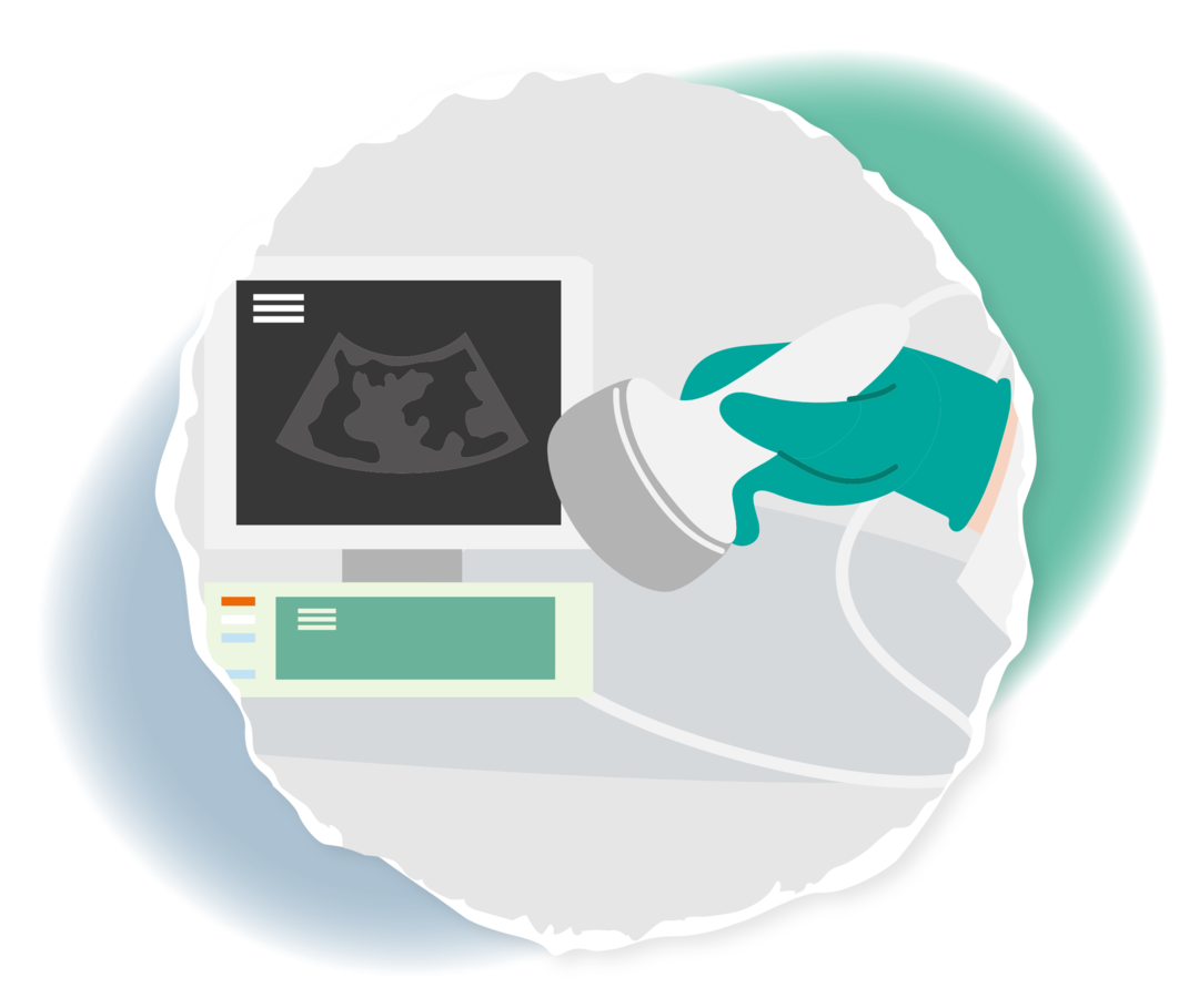 Schematische Darstellung eines Ultraschallgeräts und eines Monitors mit einem Ultraschallbild darauf.
