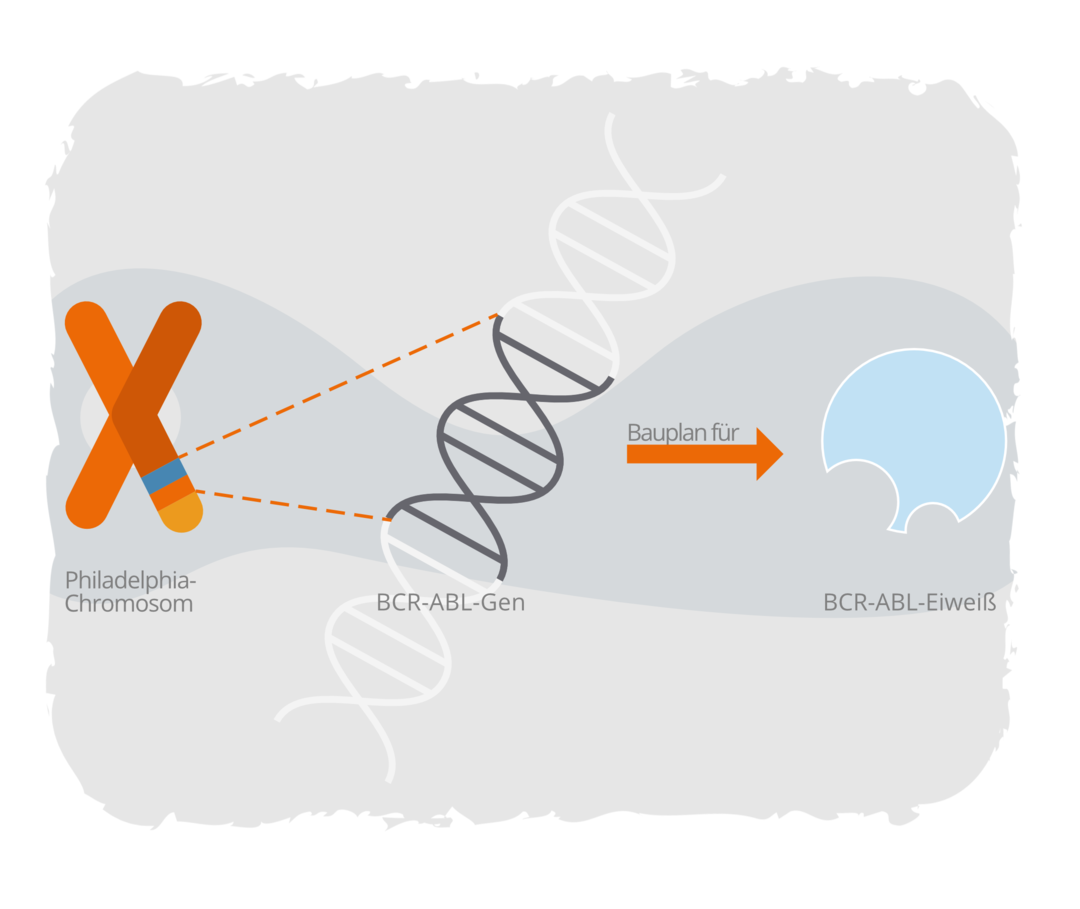 Schematische Darstellung des Philadelphia-Chromosoms und des BCR::ABL1-Genstrangs, der für das BCR::ABL1-Eiweiß codiert.