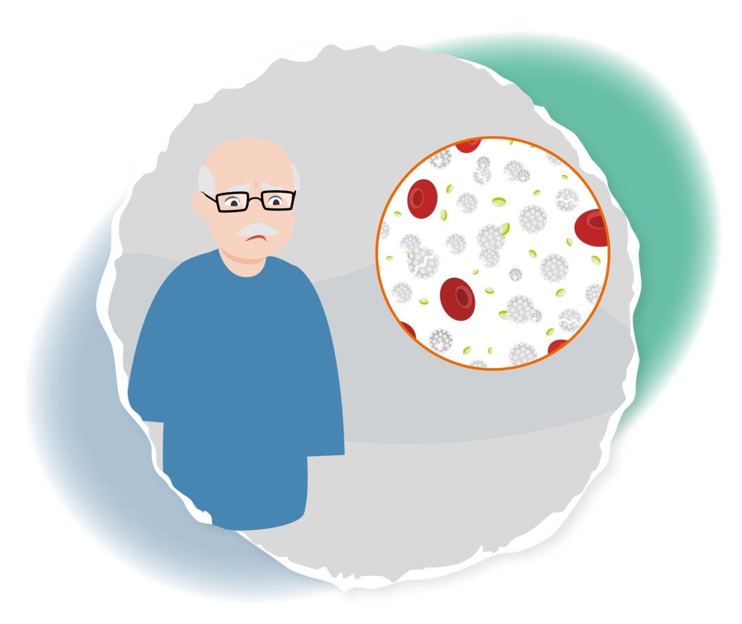 CML: Blastenphase Schematische Darstellung eines älteren Mannes mit traurigem Gesichtsausdruck. Daneben sind in einem Kreis rote und weiße Blutkörperchen sowie Blutplättchen abgebildet.