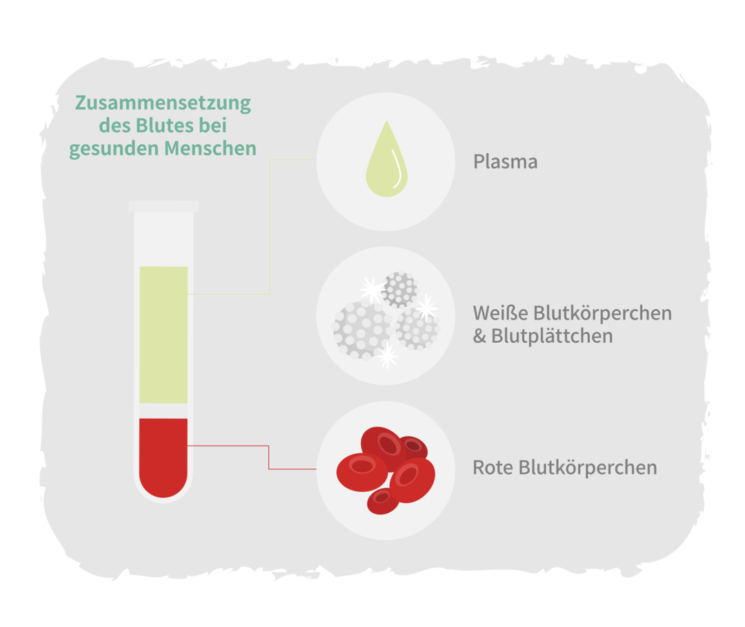 Blutzusammensetzung gesunder Mensch Schematische Darstellung der Blutzusammensetzung eines gesunden Menschen. Die drei wesentlichen Bestandteile sind in einem Röhrchen als Phasen nach einer Zentrifugation abgebildet: rote Blutkörperchen (rote Phase), weiße Blutkörperchen und Blutplättchen (weiße Phase) sowie das Blutplasma (gelbliche Phase).