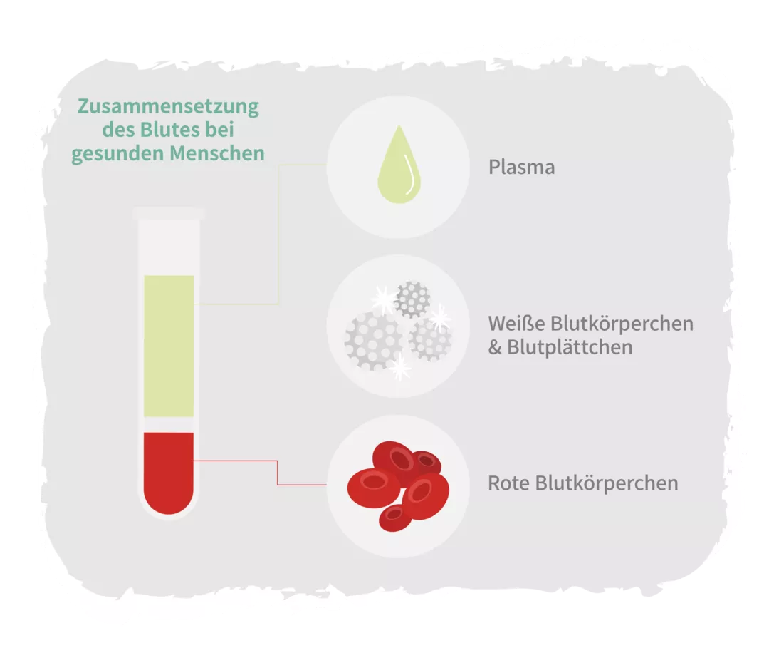 Schematische Darstellung der Blutzusammensetzung eines gesunden Menschen. Die drei wesentlichen Bestandteile sind in einem Röhrchen als Phasen nach einer Zentrifugation abgebildet: rote Blutkörperchen (rote Phase), weiße Blutkörperchen und Blutplättchen (weiße Phase) sowie das Blutplasma (gelbliche Phase). 