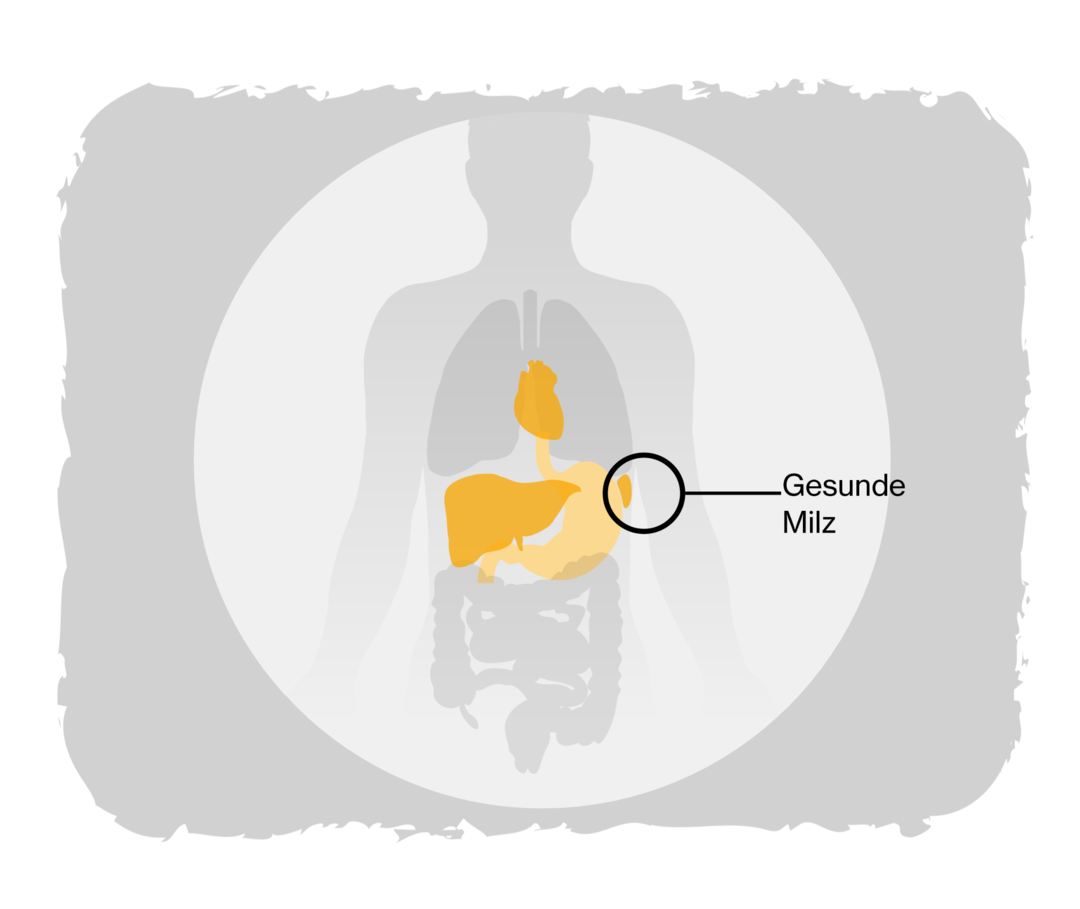 Grafik eines Menschen. Gelb hervorgehoben sind einige der inneren Organe, markiert ist die gesunde Milz. 
