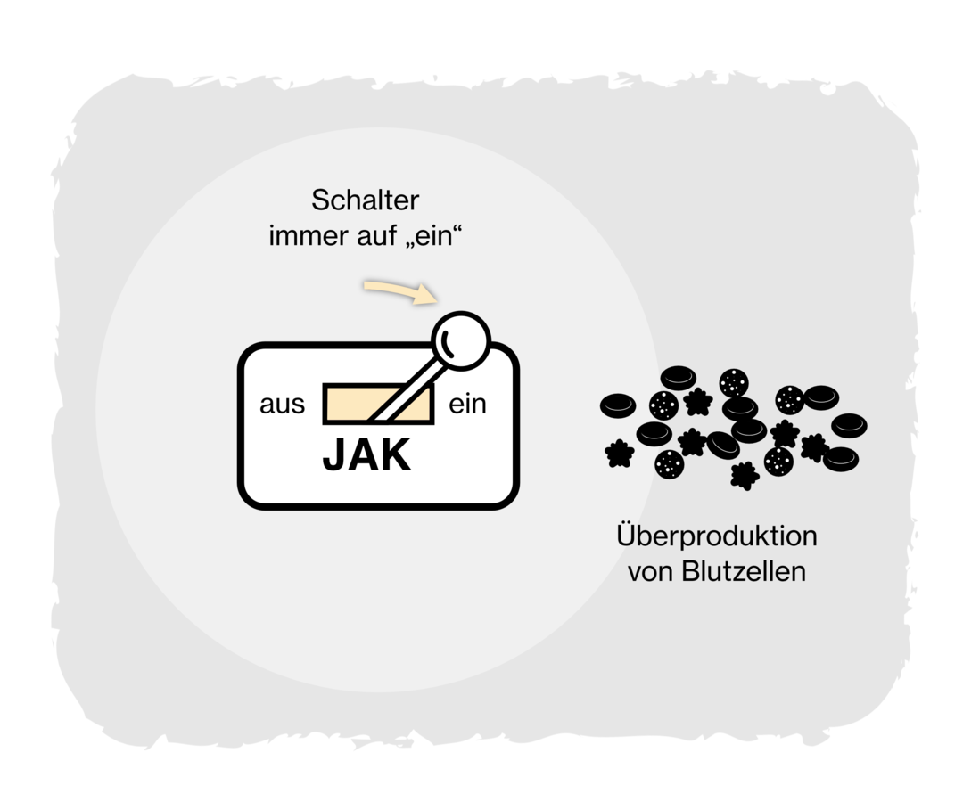Januskinase: Myelofibrose Grafik eines Schalters mit der Beschriftung „JAK“. Der Schalter ist immer auf „ein“ und führt zu einer Überproduktion von Blutzellen.