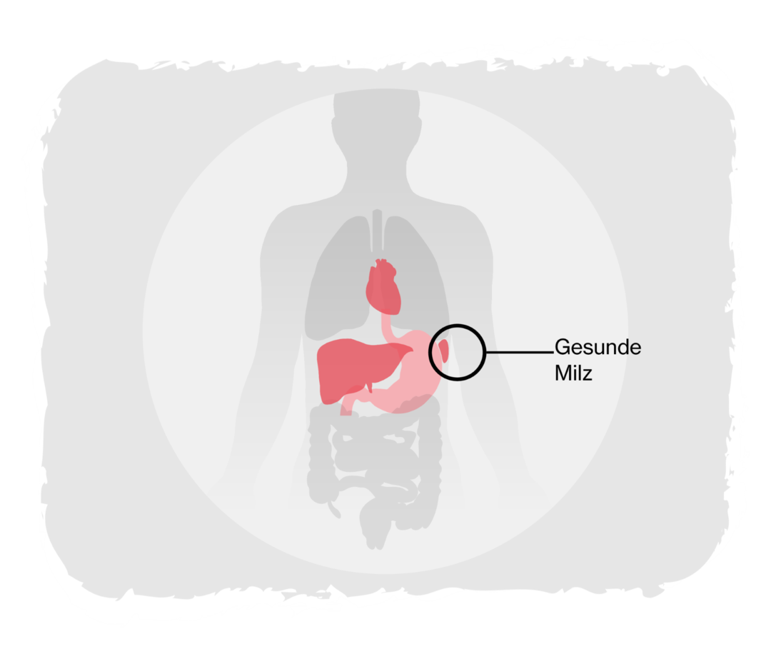 Grafik eines Menschen. Rot hervorgehoben sind einige der inneren Organe, markiert ist die gesunde Milz. 