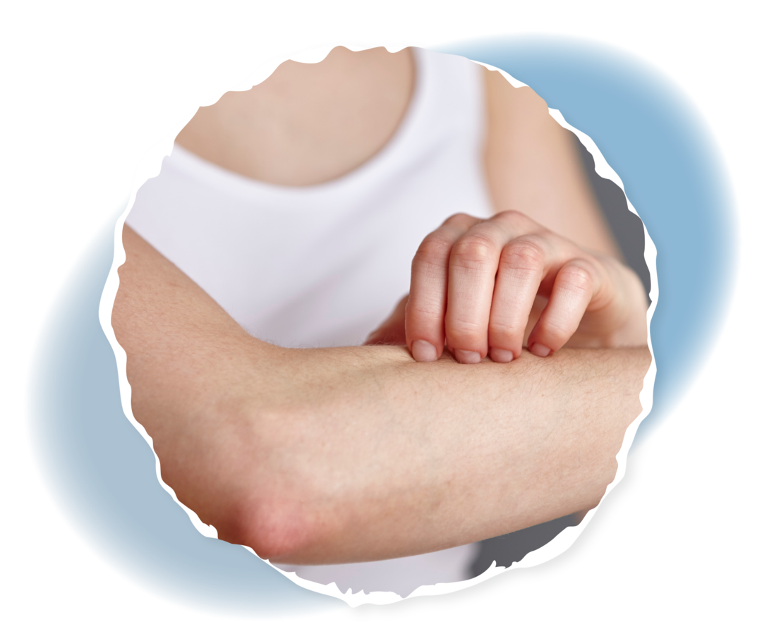 Eine Person, die sich am Arm kratzt.