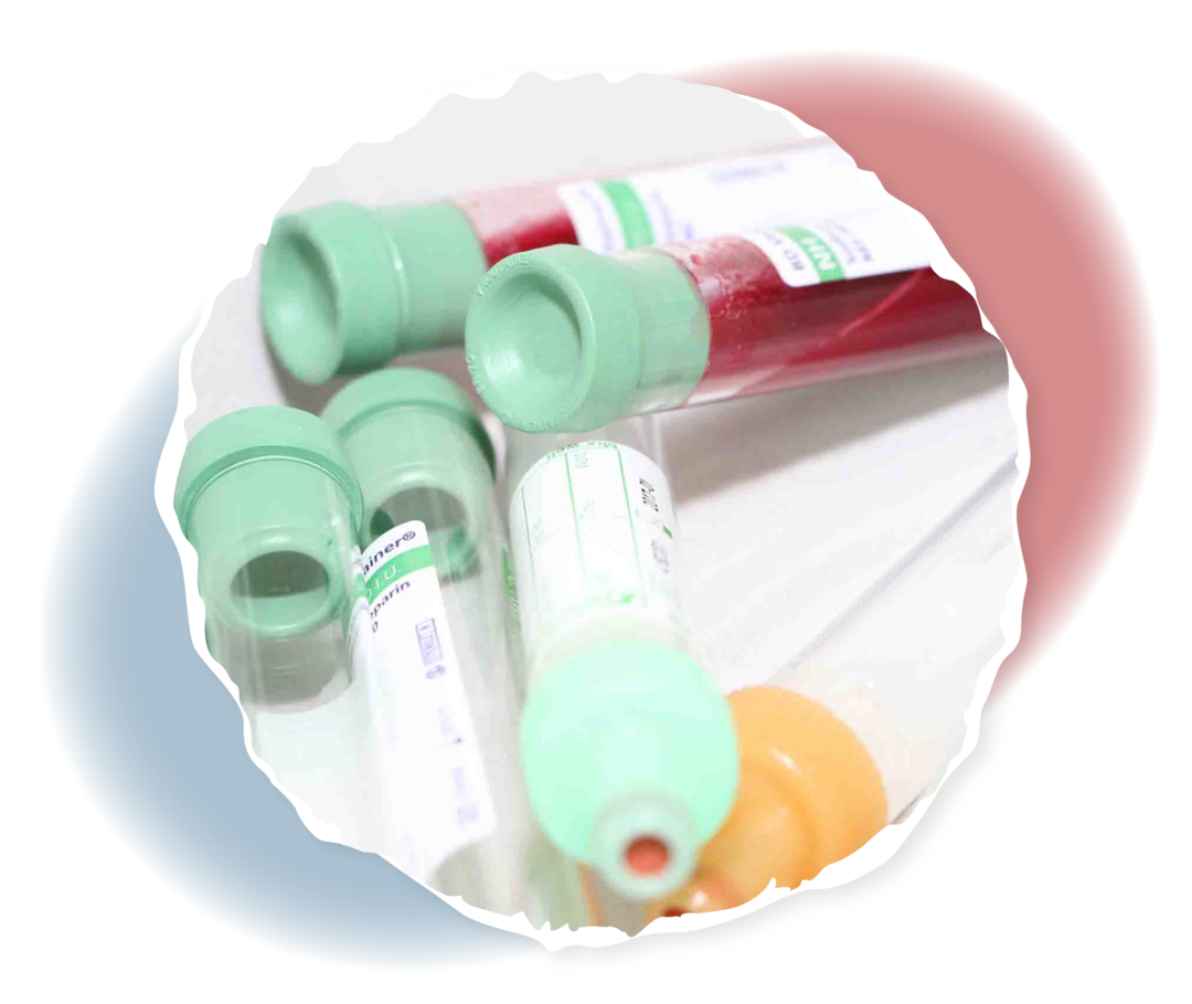 Foto von Röhrchen mit einer roten Flüssigkeit darin. 