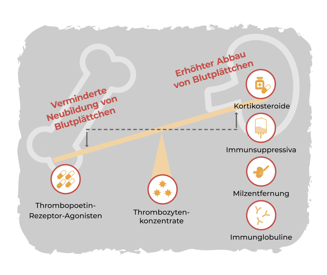 ITP: Therapiemaßnahmen Grafik zur Veranschaulichung der Therapiemaßnahmen bei ITP: Eine Waage, die nach links gekippt ist. Auf der linken Seite steht der Text: Verminderte Neubildung von Blutplättchen. Darunter: Thrombopoetin-Rezeptor-Agonisten. Auf der rechten Seite steht der Text: Erhöhter Abbau von Blutplättchen. Daneben: Kortikosteroide, Immunsuppressiva, Milzentfernung, Immunglobuline, Milz-Tyrosin-Kinase-Hemmer. In der Mitte der Waage steht: Thrombozytenkonzentrate.
