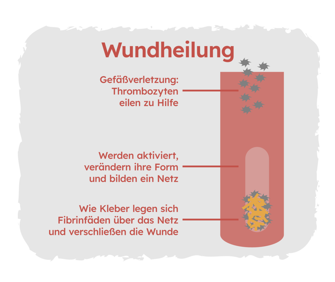 Eine schematische Darstellung eines verletzten Blutgefäßes und Thrombozyten darin mit der Überschrift: Wundheilung. Neben dem Blutgefäß stehen drei kurze Textabschnitte: Erstens: Gefäßverletzung: Thrombozyten eilen zu Hilfe. Zweitens: Werden aktiviert, verändern ihre Form und bilden ein Netz. Drittens: Wie Kleber legen sich Fibrinfäden über das Netz und verschließen die Wunde.