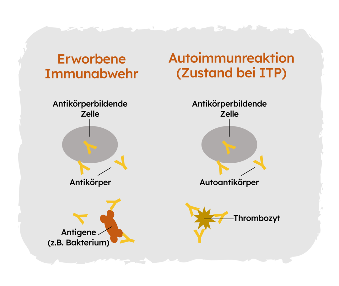 ITP: Autoimmunreaktion Zweigeteilte Grafik. Links: Eine antikörperbildende Zelle und einige Antikörper, die an ein Antigen (zum Beispiel ein Bakterium) binden. Überschrift: Erworbene Immunabwehr. Rechts: Eine autoantikörperbildende Zelle und einige Autoantikörper, die an einen Thrombozyten binden. Überschrift: Autoimmunreaktion (Zustand bei ITP).