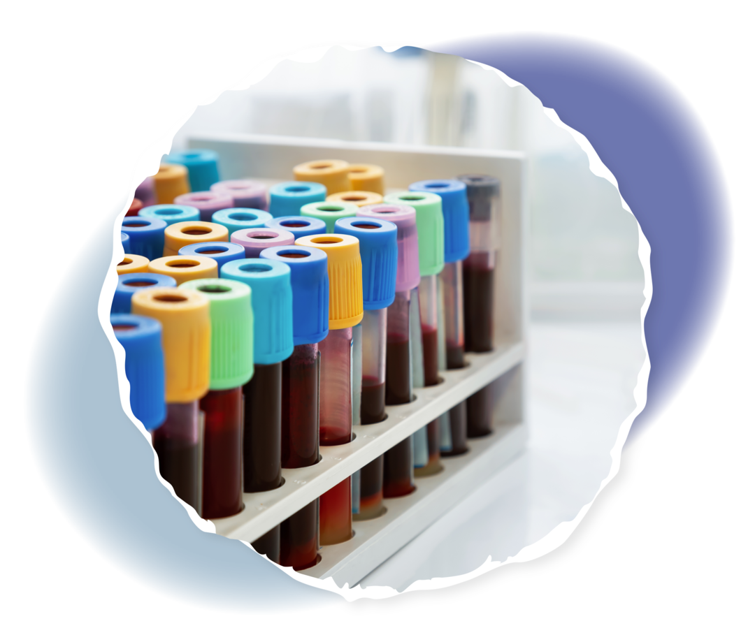 Ein Halter mit vielen verschiedenen Blutproben.