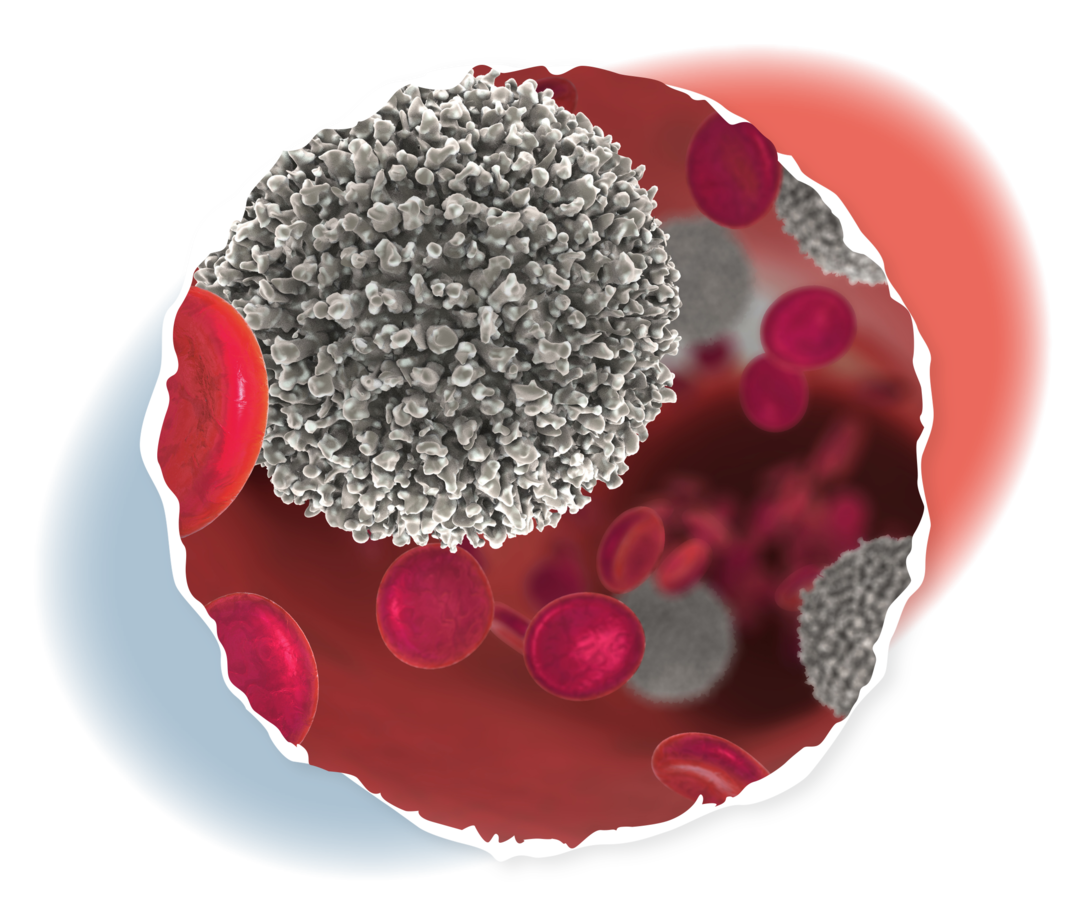 ALL: Krankheitsbild Schematische Darstellung der unreifen Lymphozyten zusammen mit Erythrozyten in der Blutbahn.