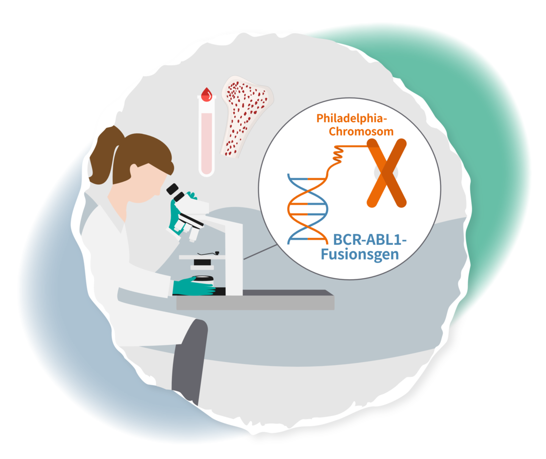 Schematische Darstellung einer Frau, die durch ein Mikroskop schaut. Daneben sind das Philadelphia-Chromosom und das BCR-ABL1-Fusionsgen abgebildet.