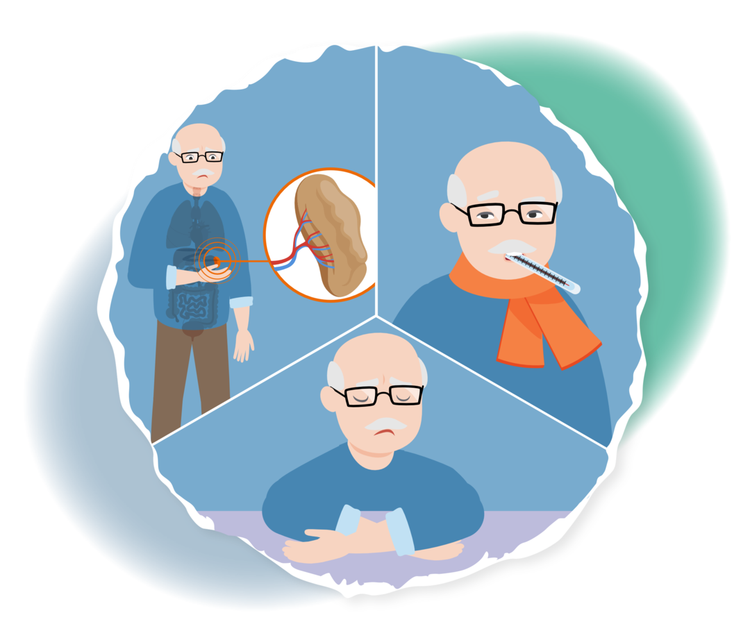 Dreigeteiltes Bild. Erster Abschnitt: Ein Mann hält sich den Bauch, daneben eine Abbildung der Milz. Zweiter Abschnitt: Ein Mann mit Fieberthermometer im Mund. Dritter Abschnitt: Ein Mann mit geschlossenen Augen unter einer Bettdecke.