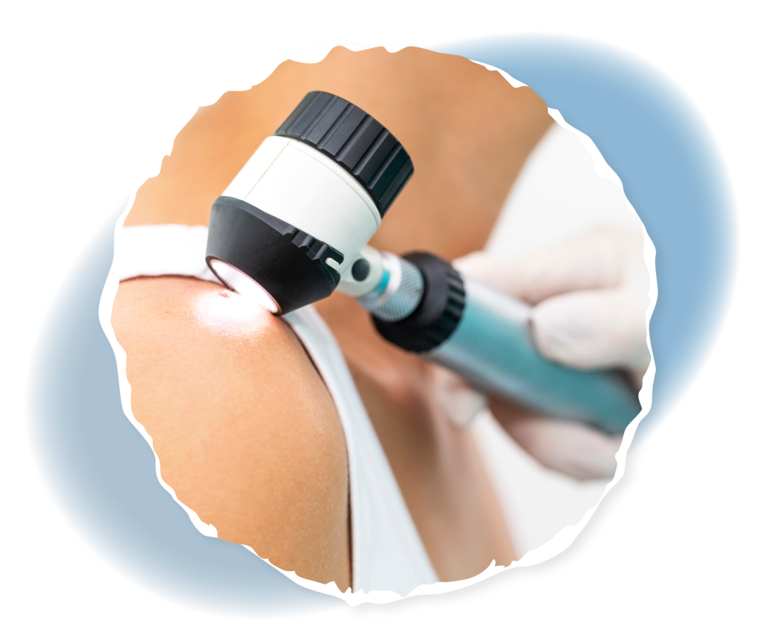 Eine behandschuhte Hand setzt ein Dermatoskop auf die Schulter einer Person auf.